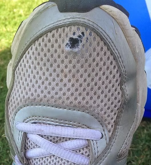 Do Your Toes Poke Holes in Your Shoes?