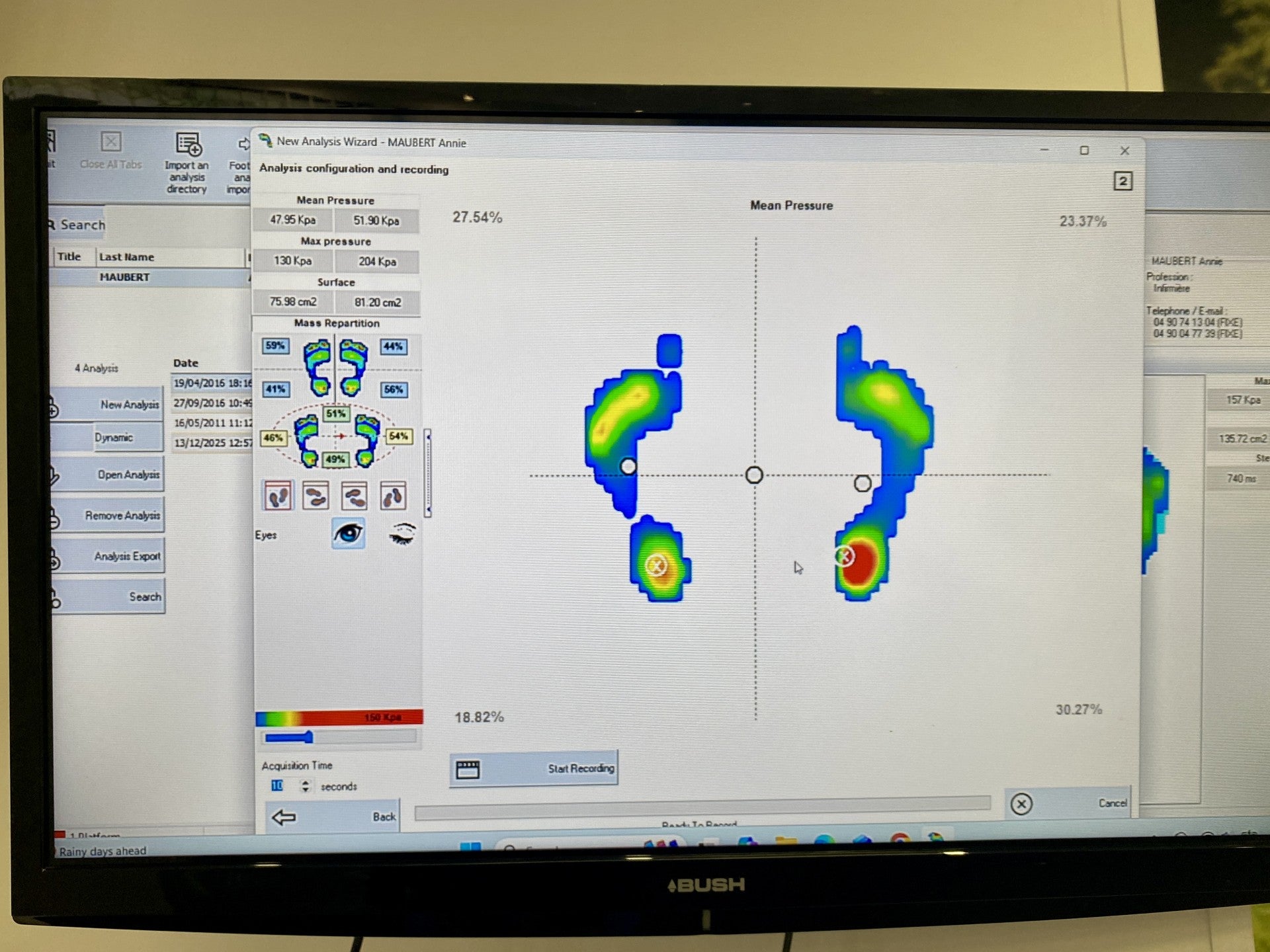 Computer screen displaying software for analyzing foot pressure distribution